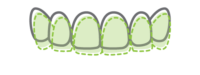 Aligners-Icons_512x191.2